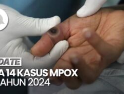 Kemenkes Temukan 14 Kasus Mpox di Tahun 2024